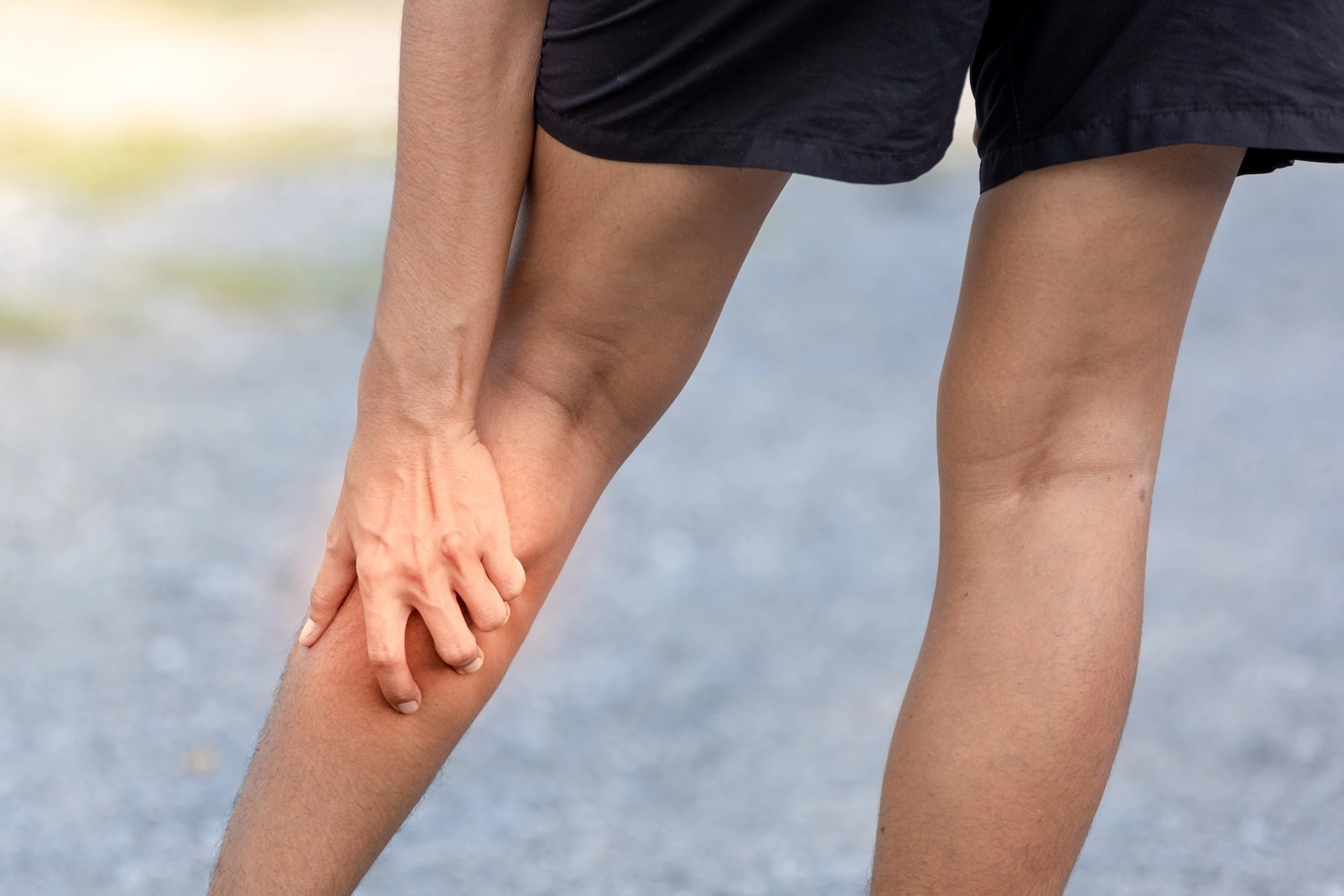 A close-up photo from behind of a person itching the back of their left calf while out on an outdoor run. 